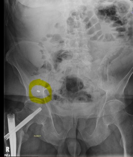 Can you spot the shocking discovery?